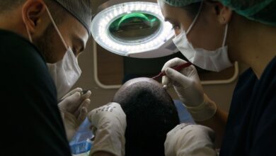 What Factors Affect the Cost of a Hair Transplant