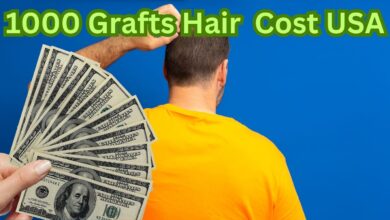 1000 Grafts Hair Transplant Costs, Results, and Benefits